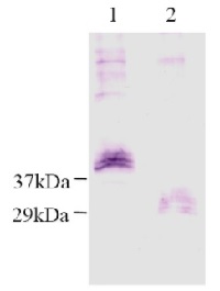 rpro-KLK5 | pro-Kallikrein 5 in the group Antibodies Human Cell Biology Research / Other proteins at Agrisera AB (Antibodies for research) (AS06 103)